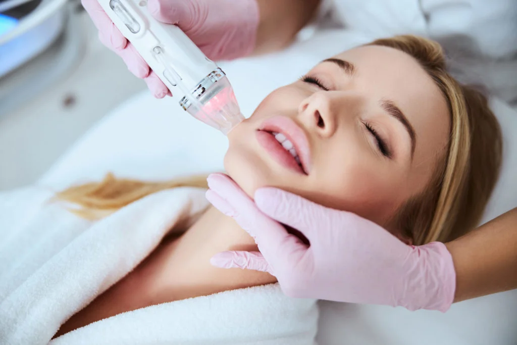 RF-Microneedling-scaled-1-1024x683
