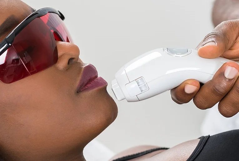 laserHairRemoval